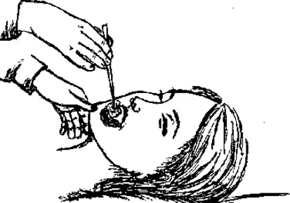 Уход за больным после инсульта. Уход за полостью рта.